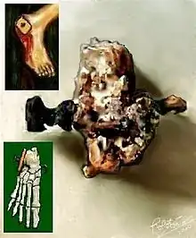 The Crucifixion of Jehohanan.