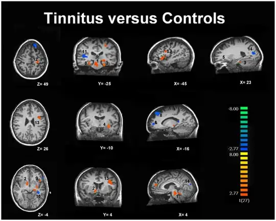 fMRI