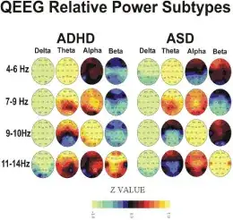sample qEEG map