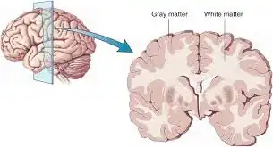 white matter