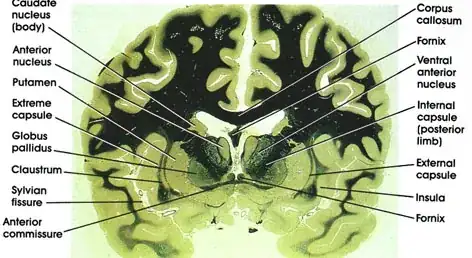 anterior commissure