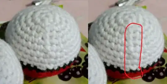 Bottoms of my balls