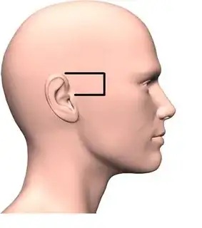 profile of a human head, with the area from the top of the ear to the top of the tragus (which is where a fixed bone sticks out) boxed in