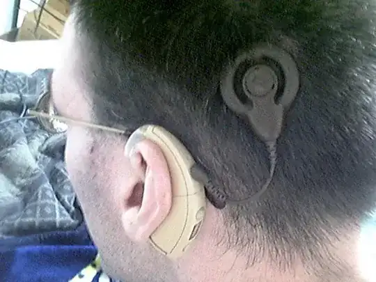 Cochlear implant attachment