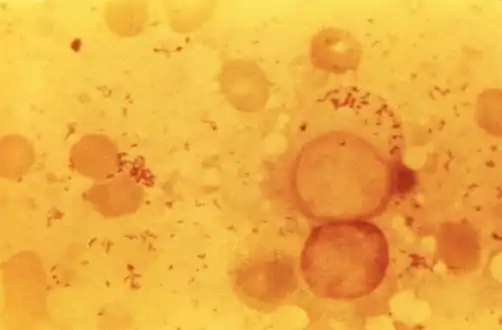 Photomicrograph of numerous, Gram-negative, Coxiella burnetii bacteria