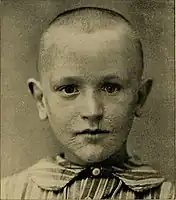 Rhagades (1895))