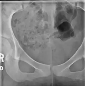 X-ray