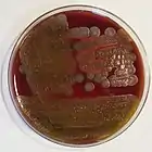 Bacillus cereus: "ground-glass" colonies displaying beta-hemolysis on blood agar: 188