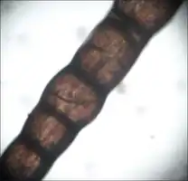 Spaces within hair shaft