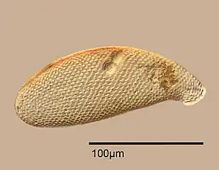 Testate amoeba, Cyphoderia&nbsp;sp.