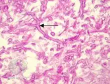 The angle of branching is near 90° (aspergillus branches at acute <45°).