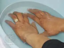 Bathwater/PUVA