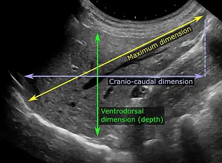 Abdominal ultrasonography of the liver, as a sagittal plane through the midclavicular line, with some standard measurements.