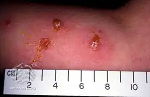 Microsporum canis