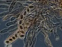 Microscopic view of numerous translucent or transparent elongated sac-like structures each containing eight spheres lined up in a row