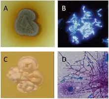 Culture: Madurella mycetomatis