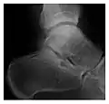 a