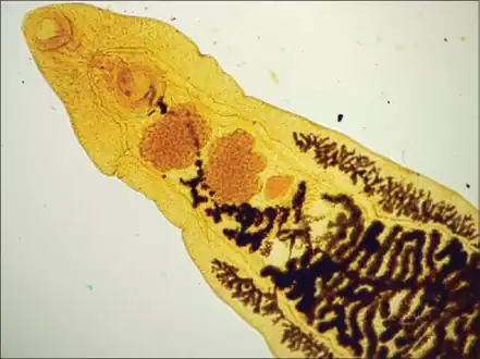 Structures at the anterior end of Dicrocoelium dendriticum