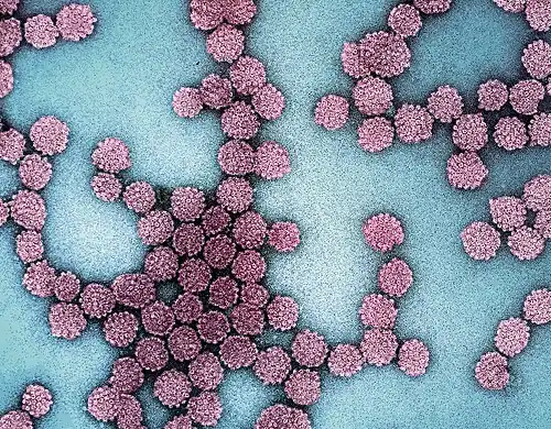 Electron micrograph of HPV virus particles  harvested from cell culture supernatant