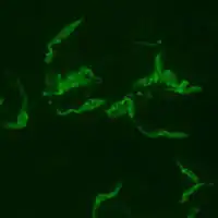 Positive IFA result with T. cruzi antigen