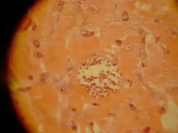 Trypanosoma cruzi amistigotes