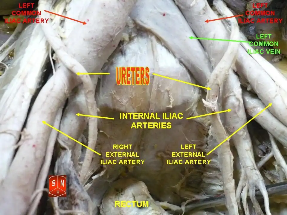Ureters