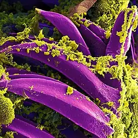 SEM  of Yersinia pestis