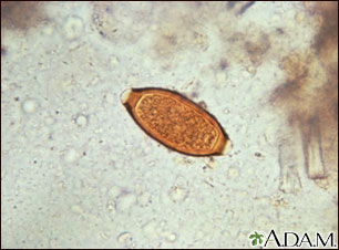 Trichuris trichiura egg Trichuris trichiura egg