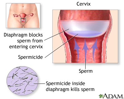 Diaphragm Diaphragm