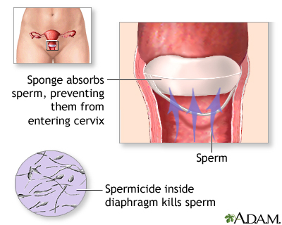 Sponge Sponge
