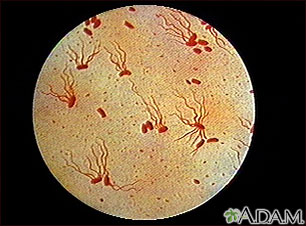 Salmonella typhi organism Salmonella typhi organism