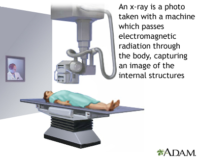 X-ray X-ray