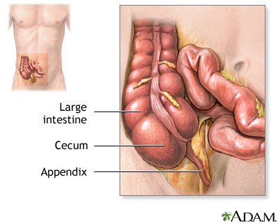 Appendix Appendix