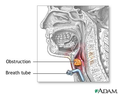 Procedure