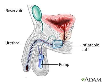 Procedure, part 2 Procedure, part 2