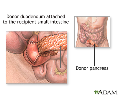 Procedure, part 1 Procedure, part 1