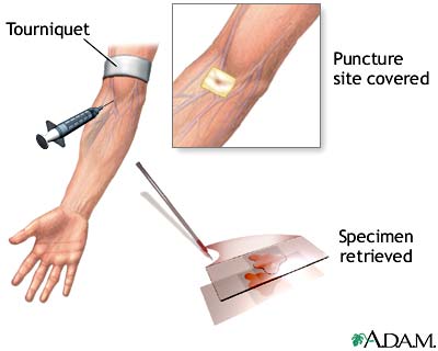 Procedure Procedure