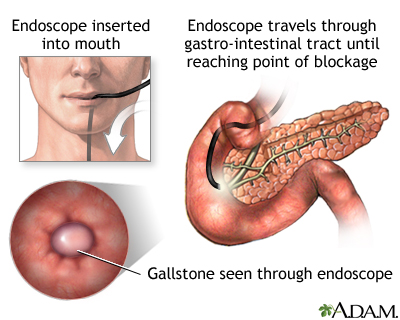 Procedure Procedure