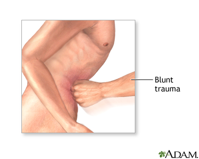 Diagnostic peritoneal lavage - series Diagnostic peritoneal lavage - series
