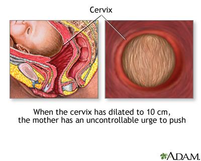 Emergency Childbirth Emergency Childbirth