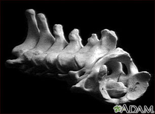 Vertebra, cervical (neck) Vertebra, cervical (neck)