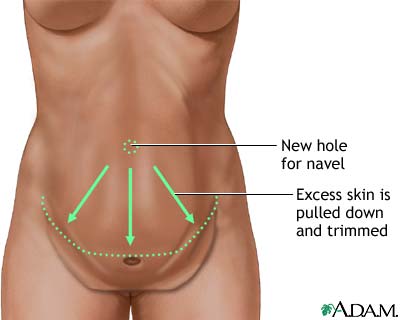 Procedure, part 3 Procedure, part 3