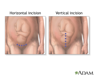 Procedure, part 2 Procedure, part 2