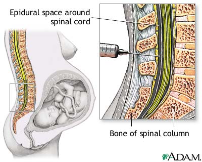 Procedure, part 1