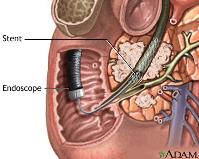 Procedure Procedure