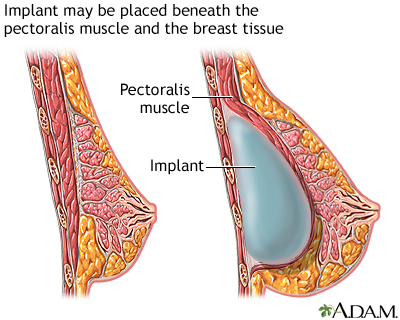 Procedure, part 2 Procedure, part 2