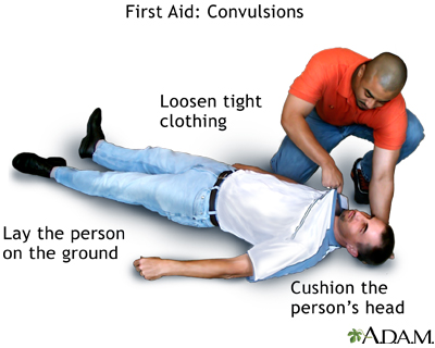Convulsions - first aid - series Convulsions - first aid - series