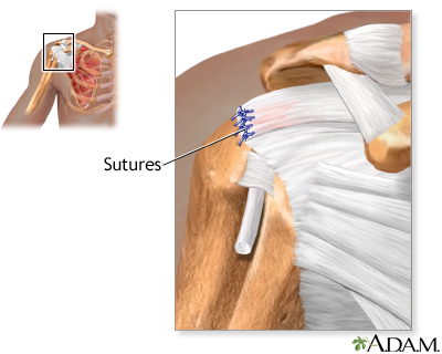 Procedure Procedure