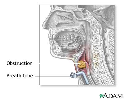 Procedure Procedure