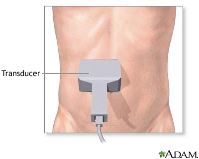 Abdominal ultrasound Abdominal ultrasound